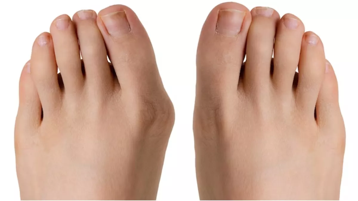 Toenail Pain: पैरों के नाखून दर्द करने पर अनपाएं ये तरीका