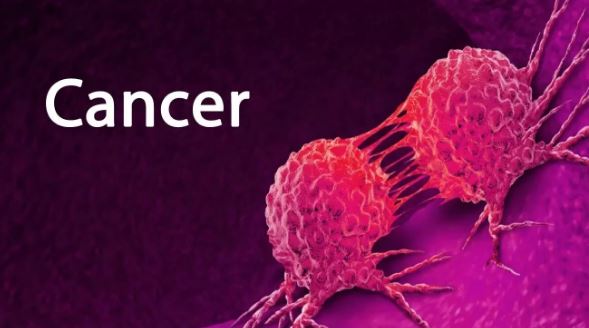 Cancer: शोध और उपचार में बढ़त, एक बेहद खतरनाक बीमारी