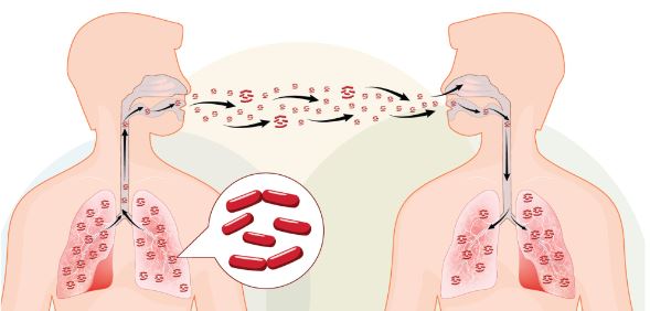 Tuberculosis: अब क्षय रोग के लक्षणों के हिसाब से होगे अस्पताल के स्तर तय, बड़े अस्पतालों में दी जाएगी उपचार की सुविधा