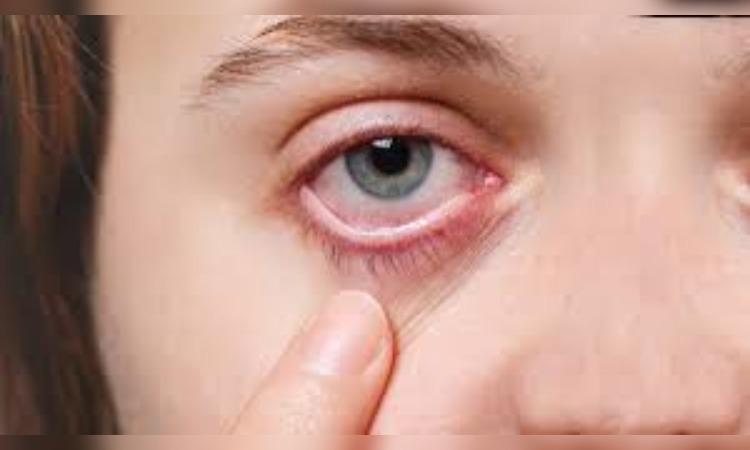 Puffy Eyes Reasons: इन कारणों की वजह से आ जाती है आंखों के आसपास सूजन, ऐसे करें बचाव