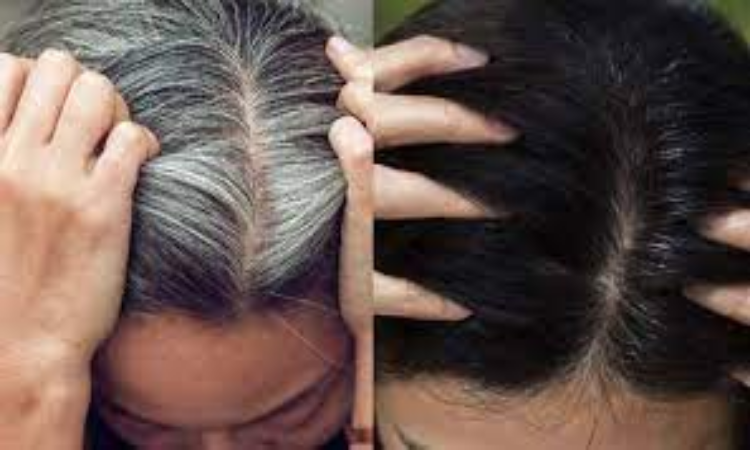 White Hair Problem: सर पर बढ़ते सफेद वालों से परेशान? इन घरेलु नुस्खों से करें जड़ से इलाज